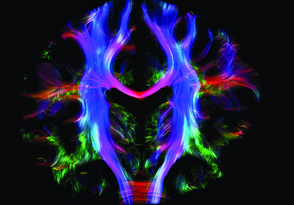 FUSF Tractography workshop cover