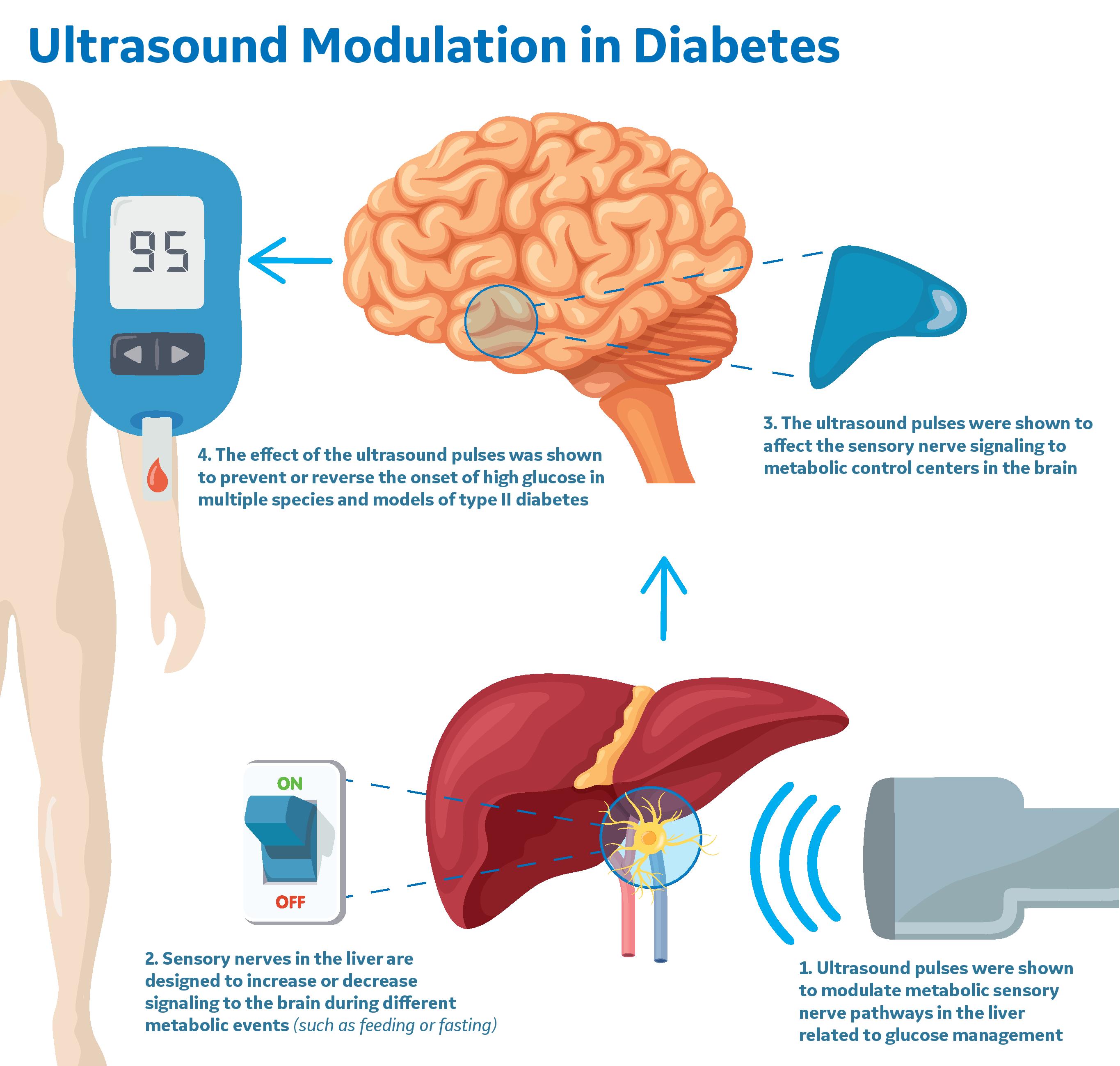 Ultrasound Modulation in Diabetes final credit GE Research
